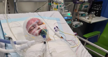 Junee family seeks help after son suffers third-degree burns