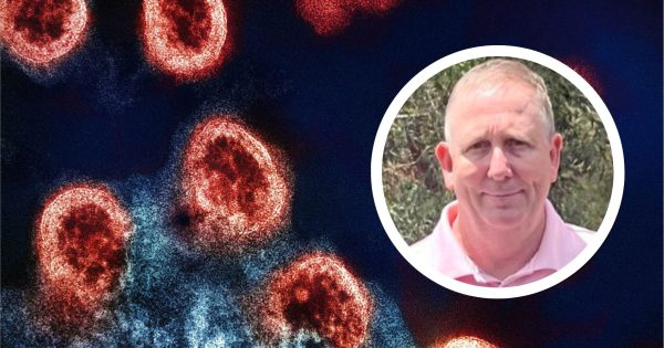 Potential HIV vaccine is 'one step closer', says CSU expert