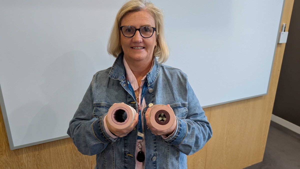 Peta Anderson showing airways not affected by asthma vs those that are. 