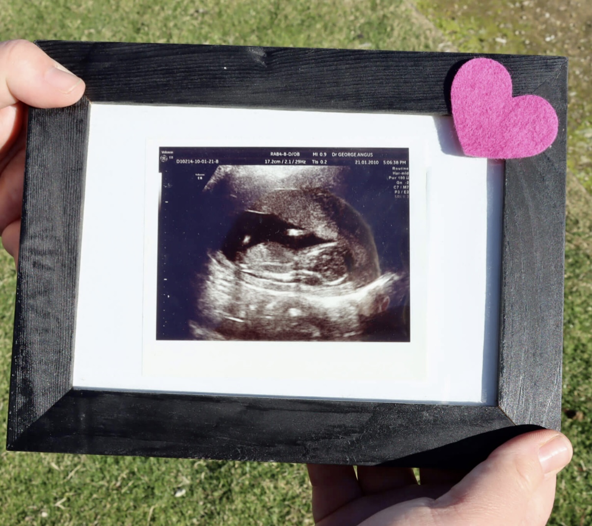 A Vilomah family shares its scan of their beloved baby. Picture courtesy Vilomah Community.