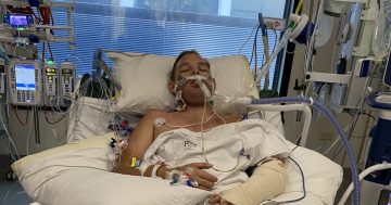 Riverina mum appeals for help as son recovers from horrific motorbike accident